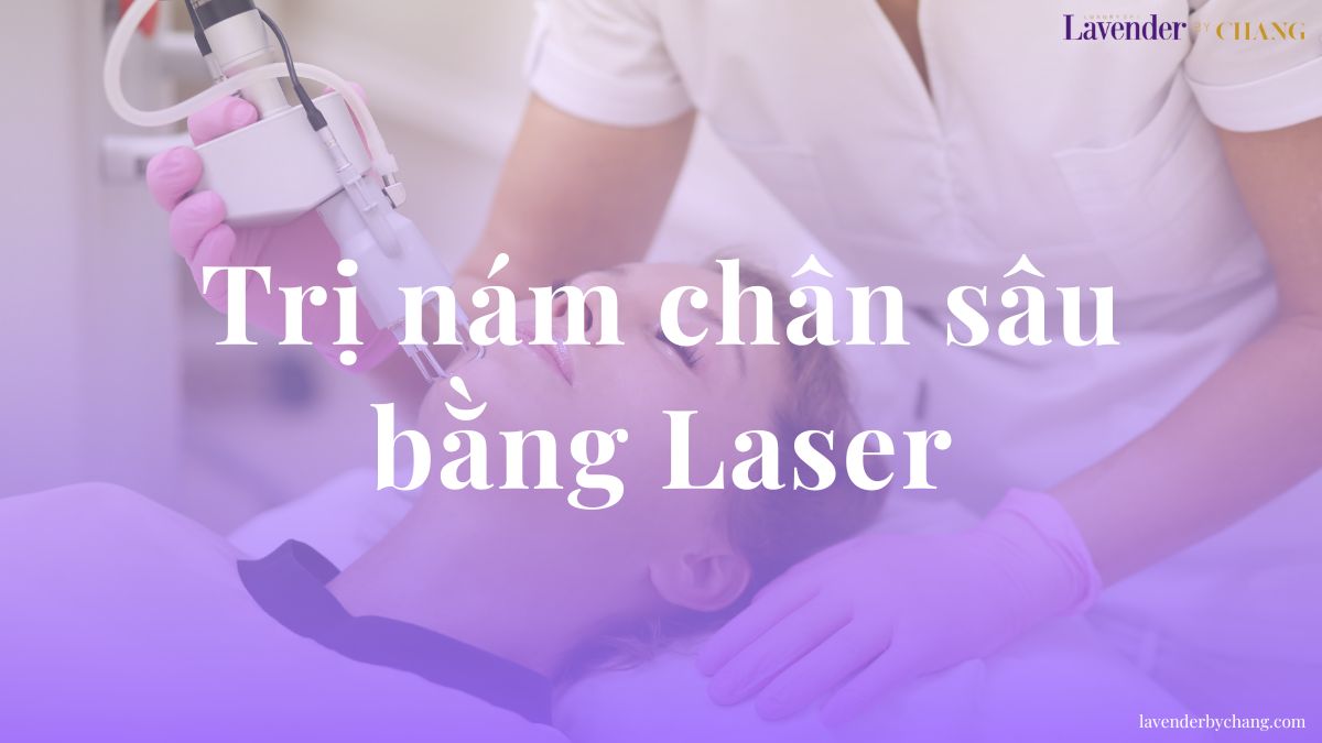 trị nám chân sâu bằng laser