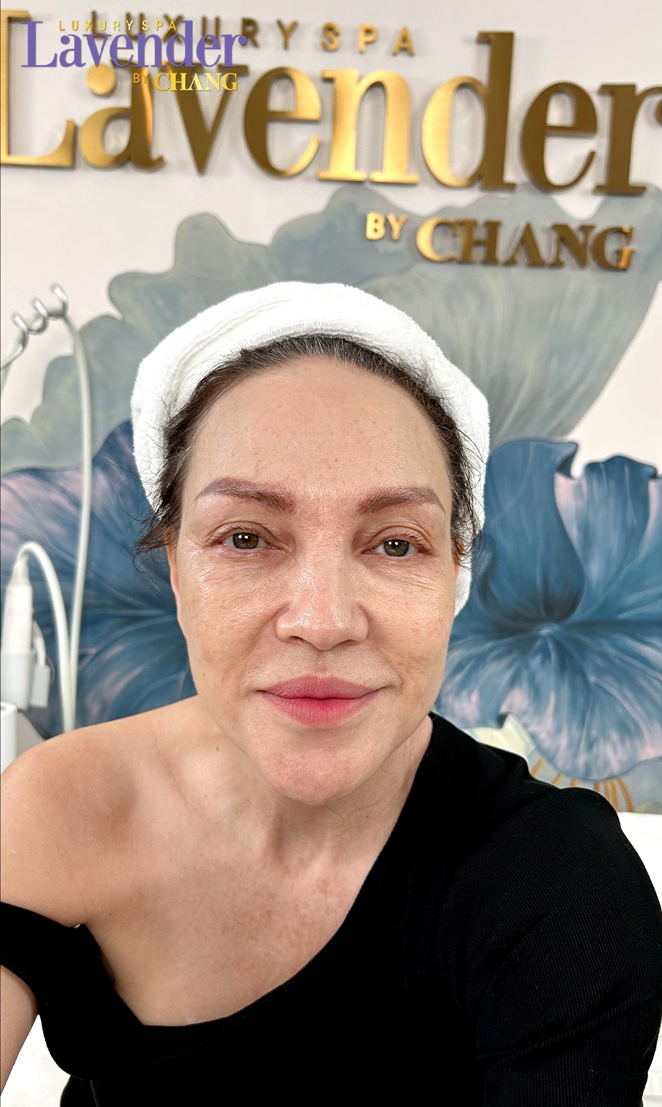 bao nhieu tuoi nen lam thermage 27653 3 - lavender by chang