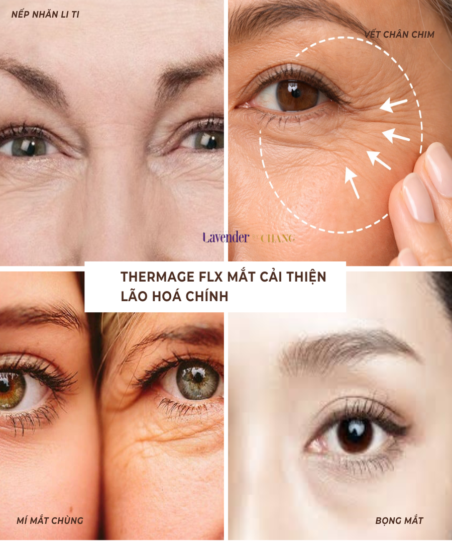 thermage flx mat 27668 2 - lavender by chang