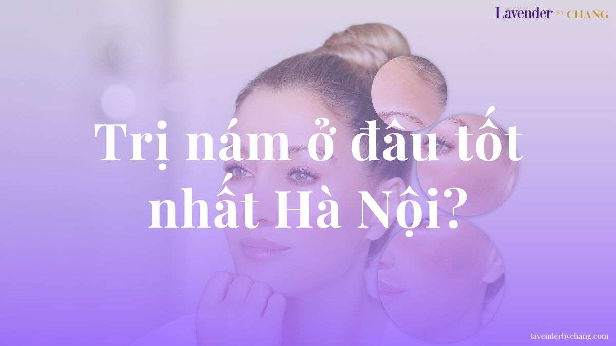 trị nám ở đâu tốt nhất hà nội