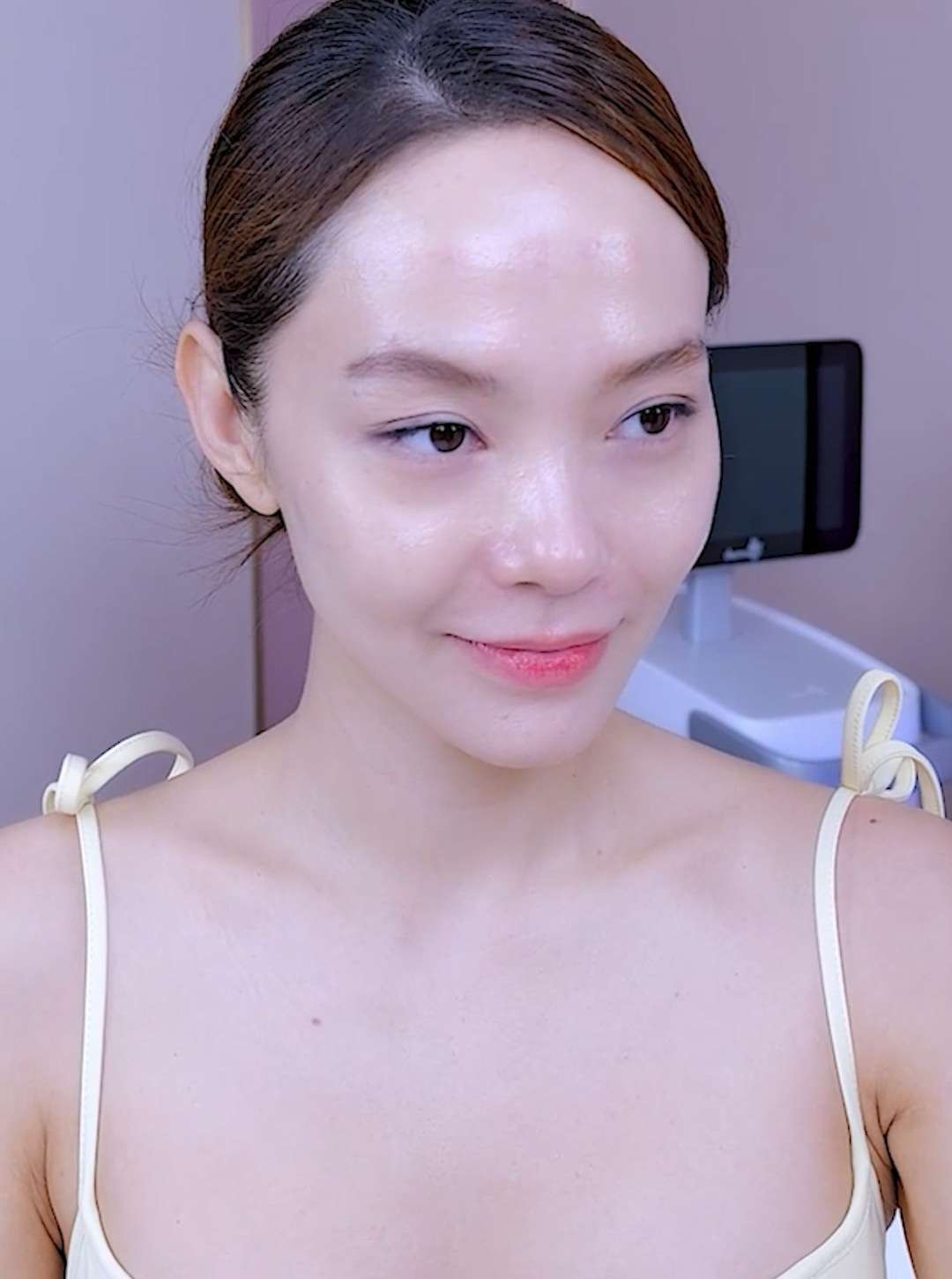 ca si minh hang lam thermage v lift 1 - lavender by chang
