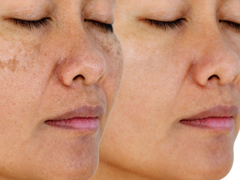 cham soc da sau laser tan nhang 29751 6 - lavender by chang