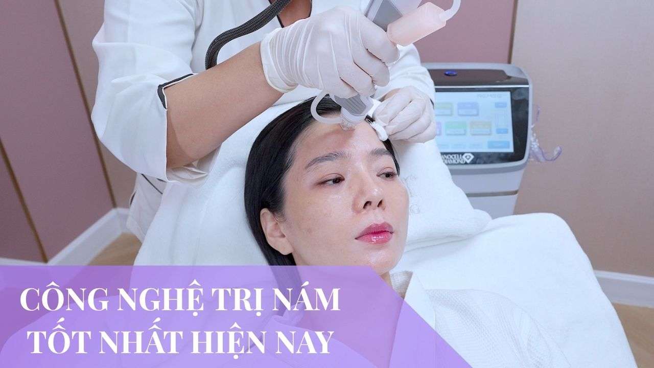 6 công nghệ trị nám da tốt hiện nay cho từng loại nám