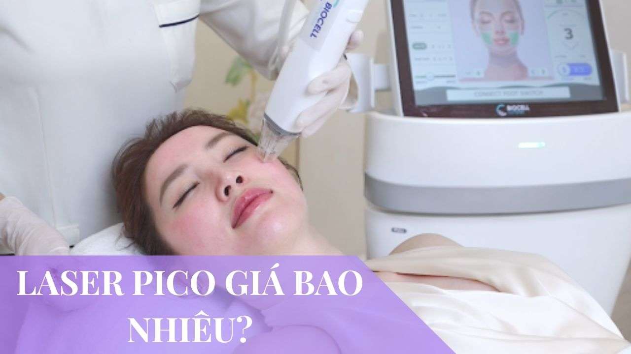 Laser Pico giá bao nhiêu? Bảng giá điều trị mới 2026