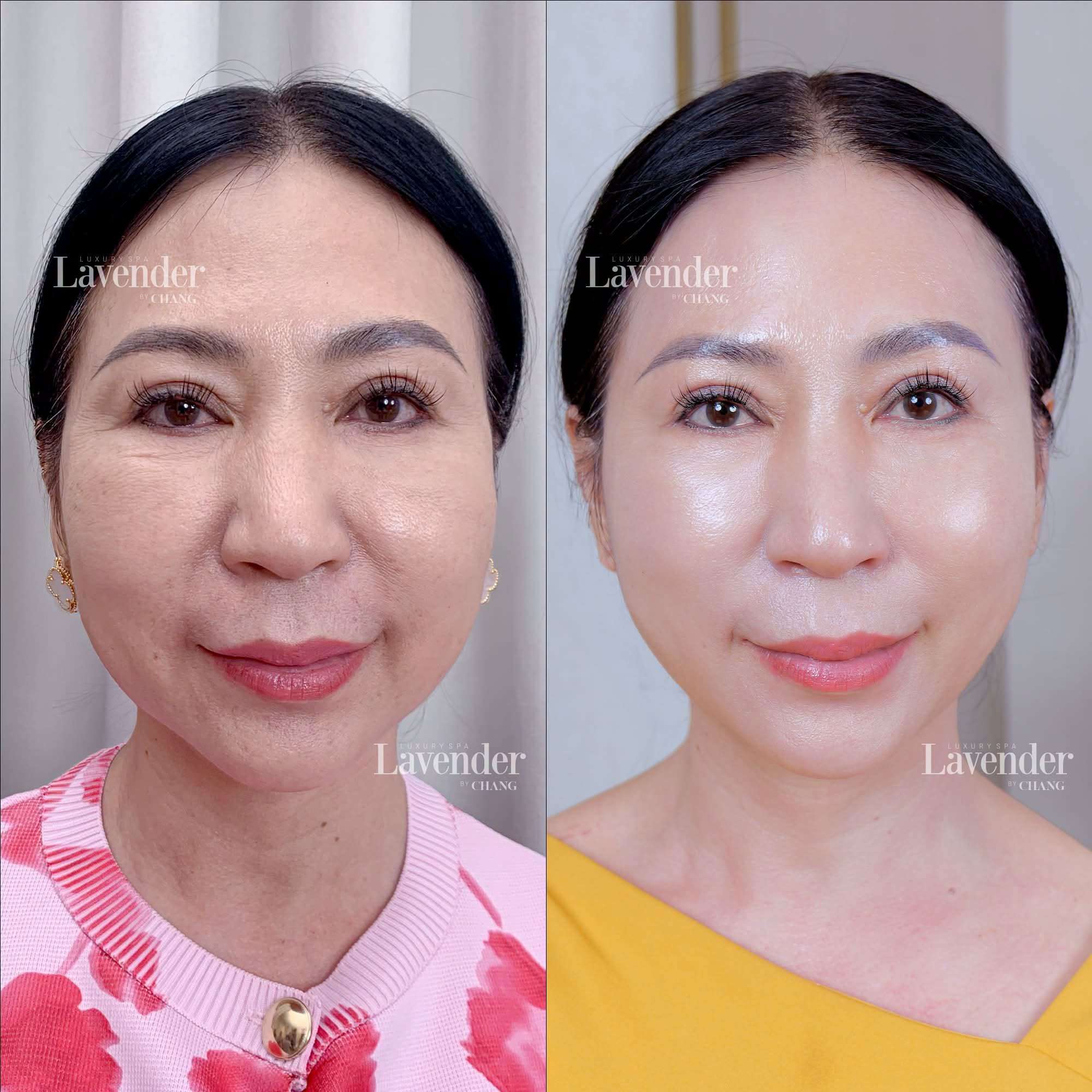 lieu trinh tre hoa da mat gia bao nhieu 30839 3 - lavender by chang