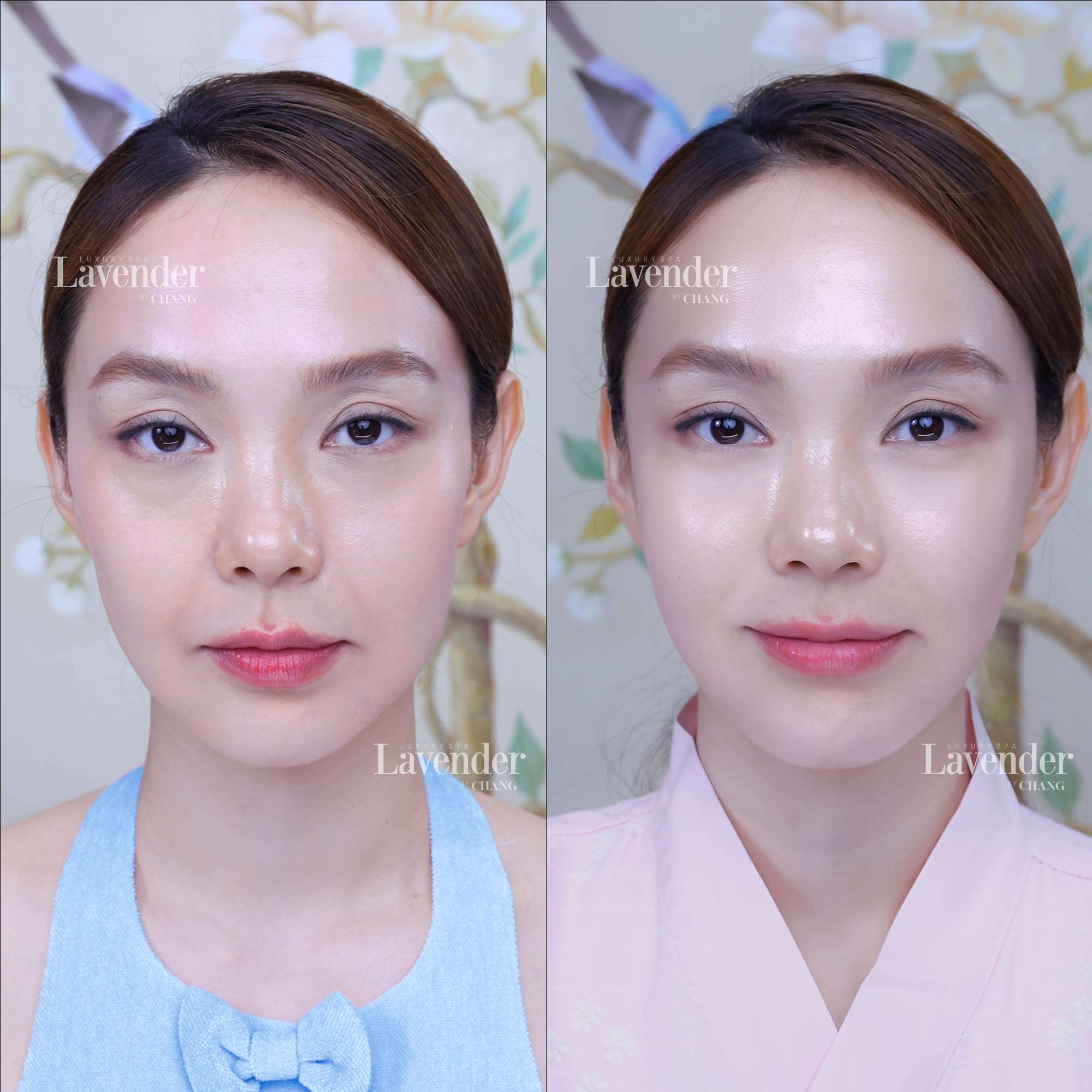 lieu trinh tre hoa da mat gia bao nhieu 30839 - lavender by chang