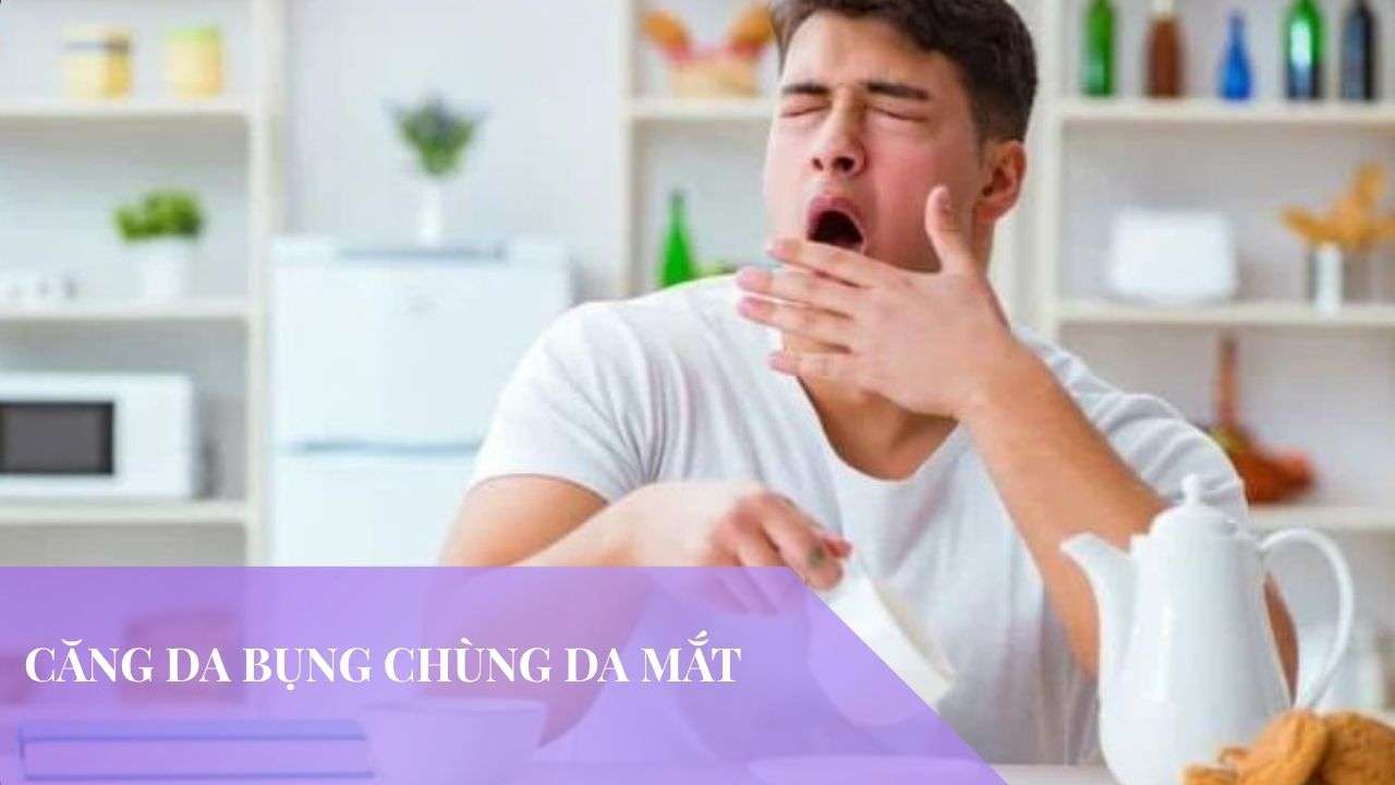 Căng da bụng chùng da mắt