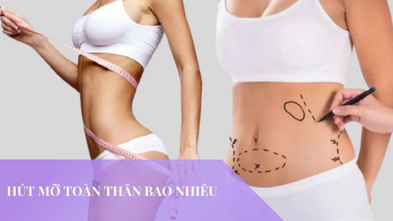 hút mỡ toàn thân bao nhiêu