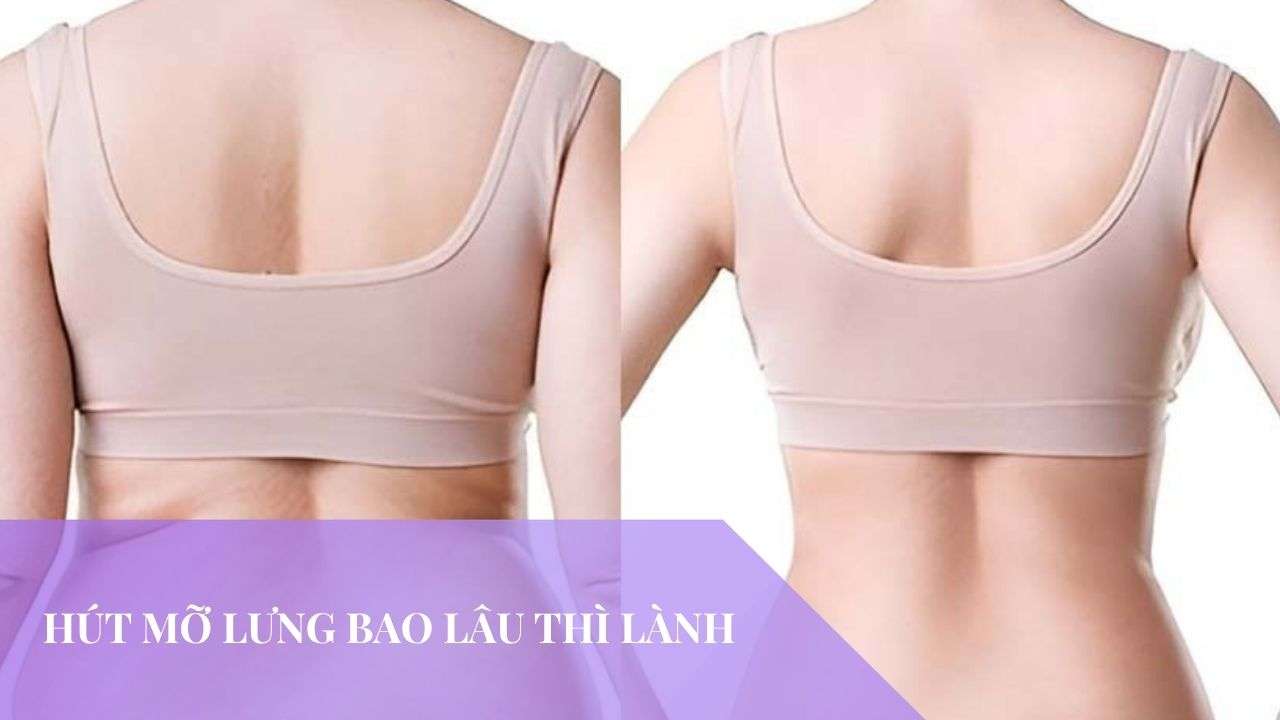 Hút mỡ lưng bao lâu thì lành? 5 giai đoạn hồi phục