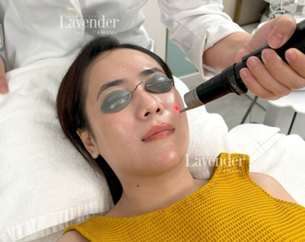 Laser Pico phát xung cực ngắn tác động lên vùng sắc tố trên da 