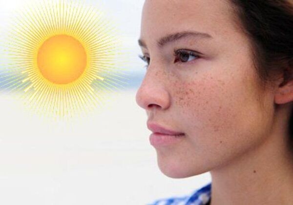 Ánh nắng là một trong những yếu tố quan trọng có thể kích hoạt và làm nám đậm hơn. 