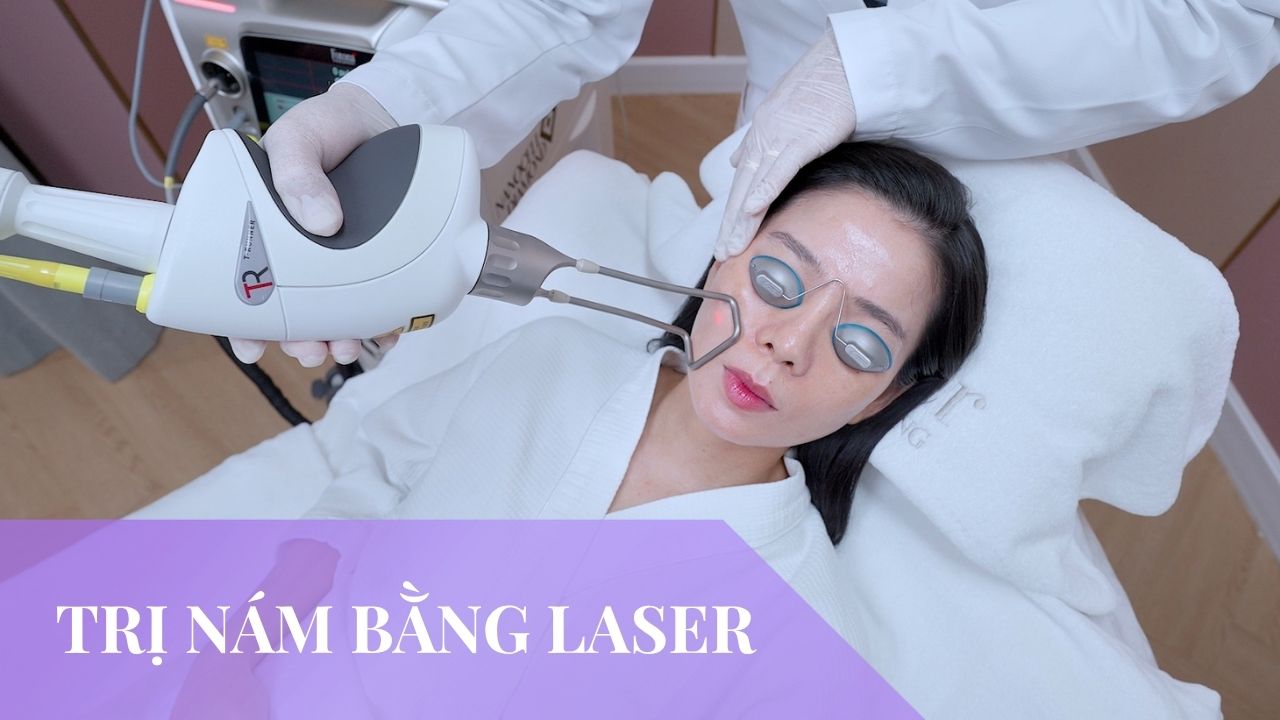 Trị nám bằng laser