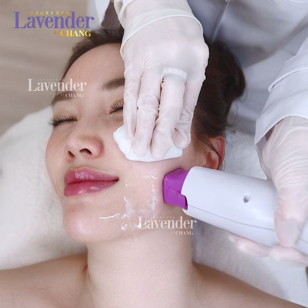 cang da thermage hieu qua chi phi va nhung dieu can biet 33952 - lavender by chang